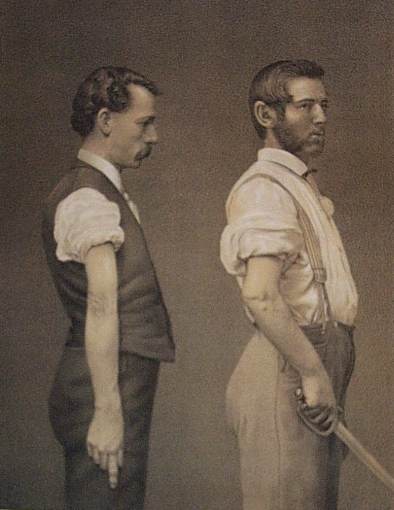 civil war soldiers that were wounded